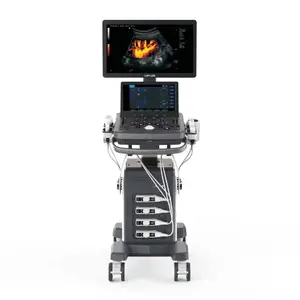 Система ультразвукова діагностична Zoncare ViV 20 купити