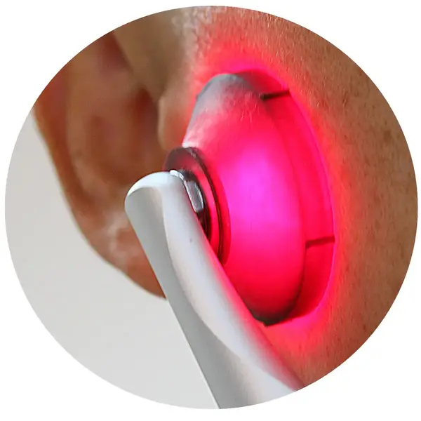 Червона насадка для фотобітомодуляції DentLight купити