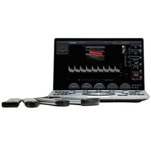 Ветеринарний ультразвуковий апарат CHISON SonoAir 30 (3 датчики) купити