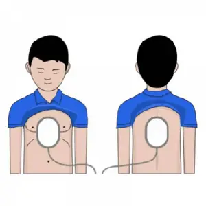 Електроди для дітей AED Amoul купить
