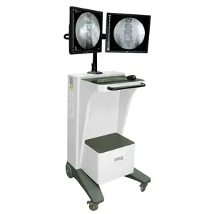 Рентген С-арка Anyview 500R купити