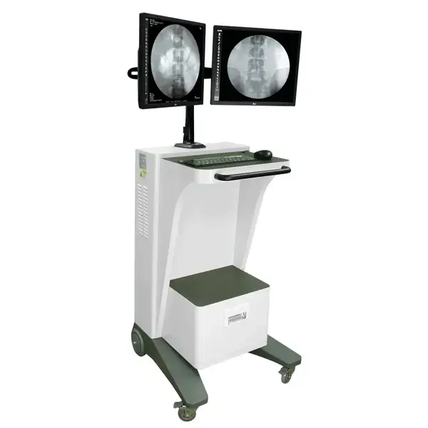 Рентген С-арка Anyview 500R купити