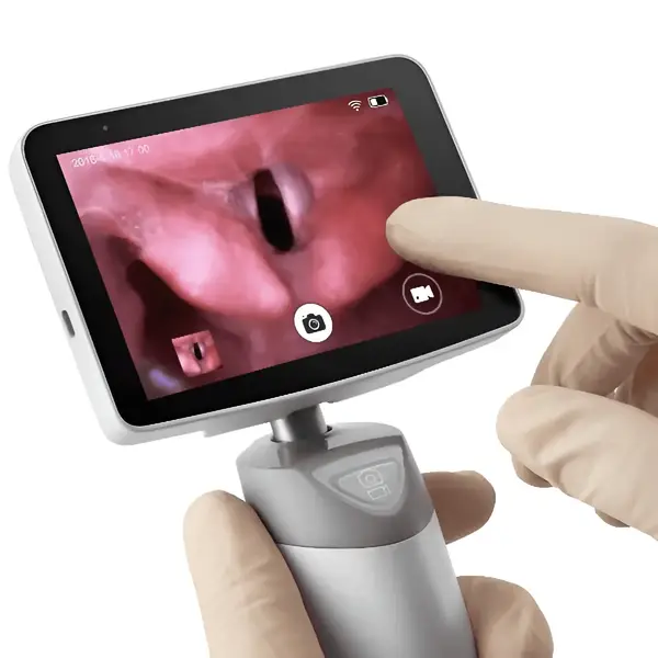 Diamond video laryngoscope