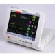 Fetal monitor BF500C