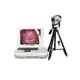 Digital portable colposcope LAPOMED® (720p HD)